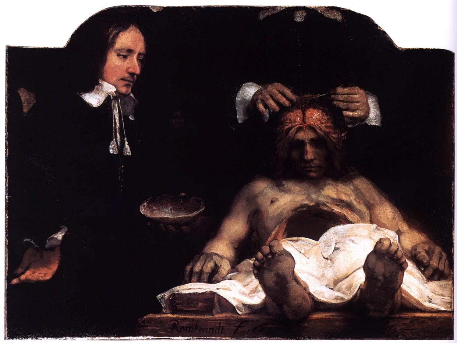 La lezione di anatomia di Joan Deyman - Historisch Museum, Amsterdam